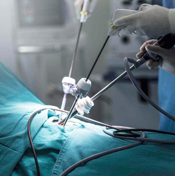 Paediatric Laparoscopic Surger